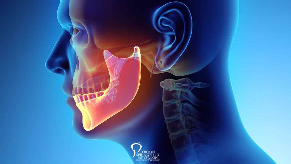 Nutrition for Healthy Jaw Bones