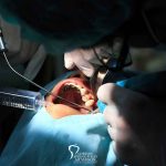 How to Get an Oral Surgery Referral featured
