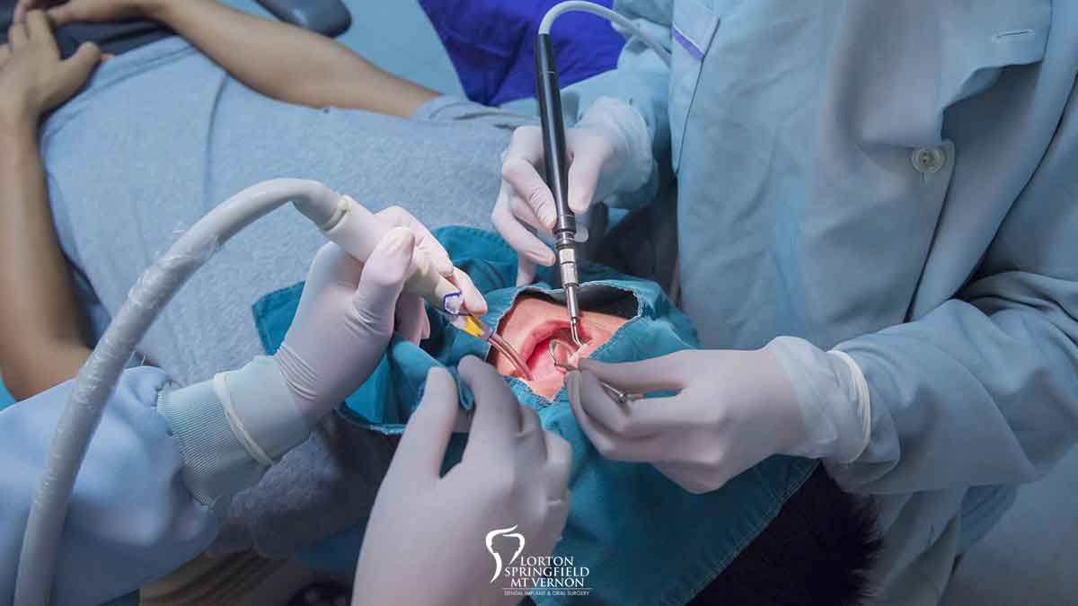 When to Visit an Oral Surgeon