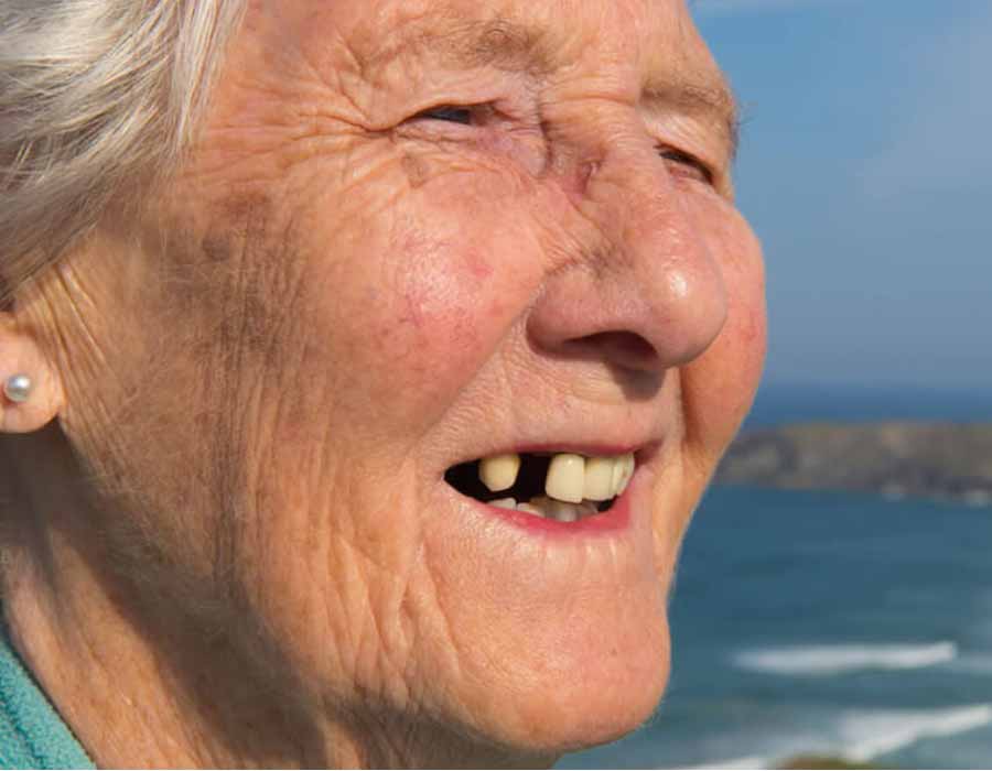 elderly-woman-missing-teeth