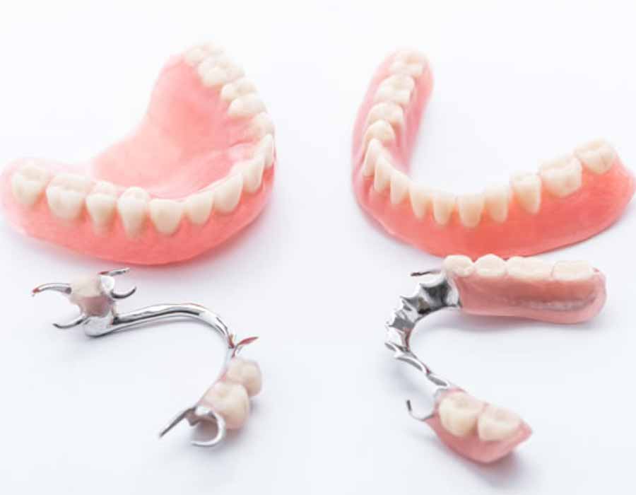 examples-of-dentures-and-bridges