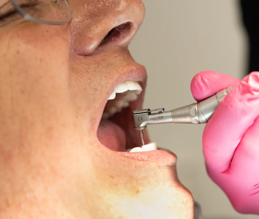 Bone Grafting All About