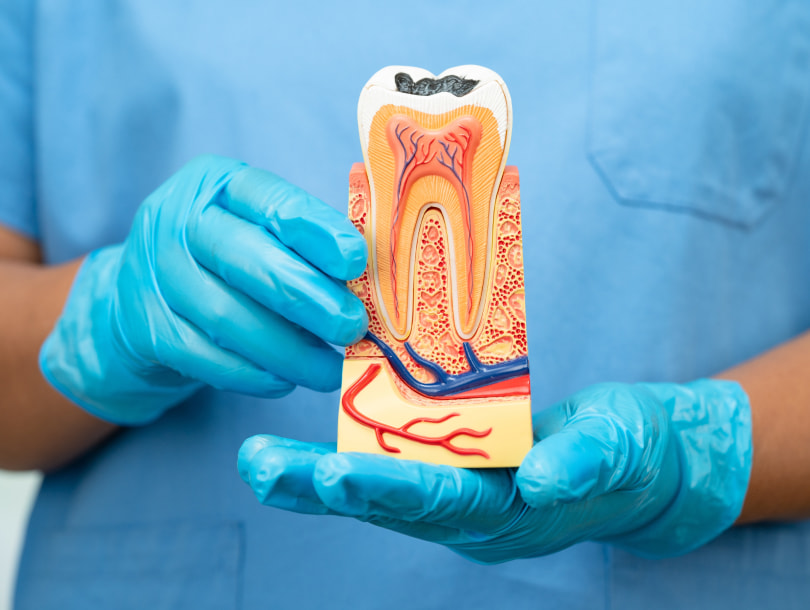 Benefits from Root Amputation